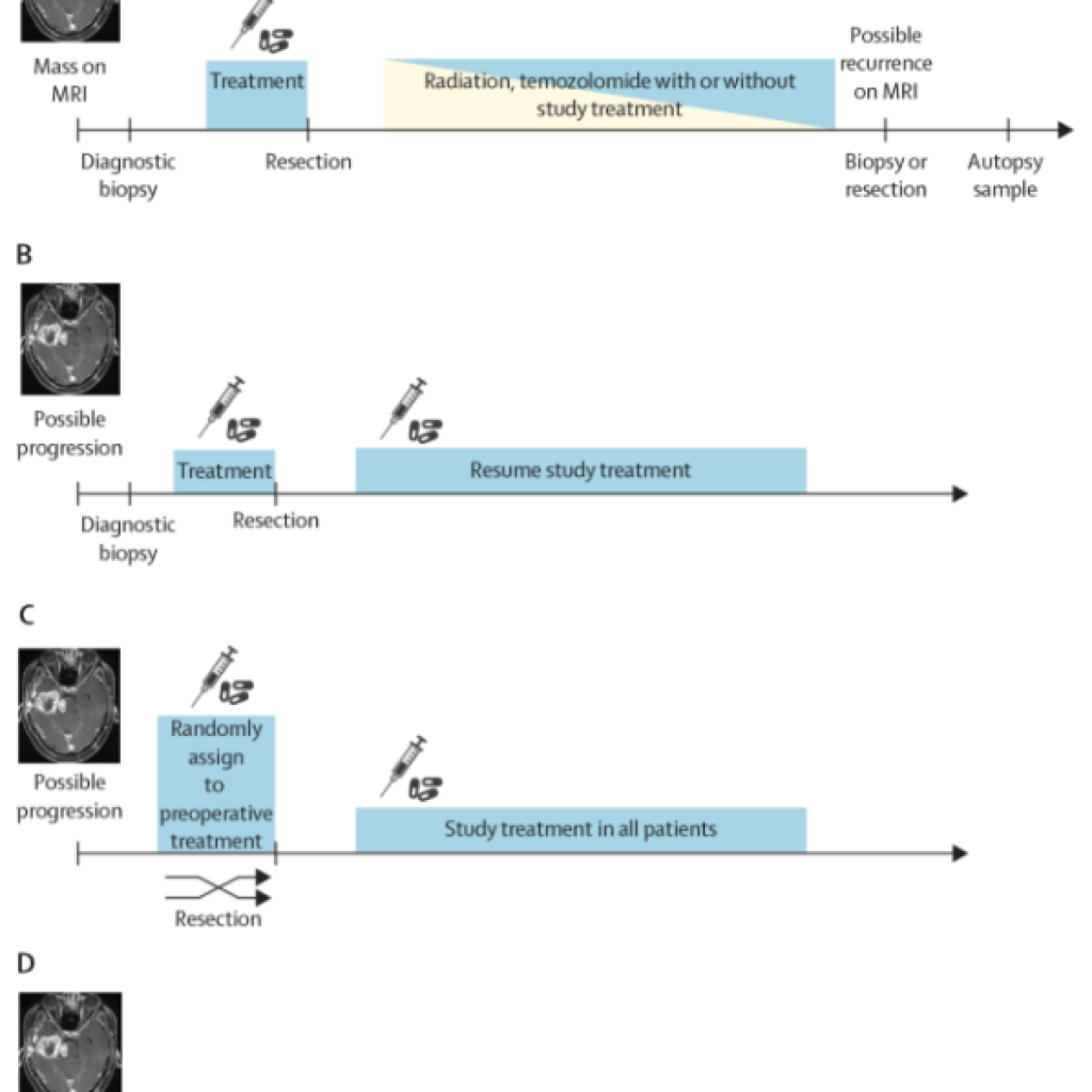 A brave new framework for glioma drug development
